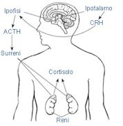 Ipercortisolismo o sindrome di Cushing