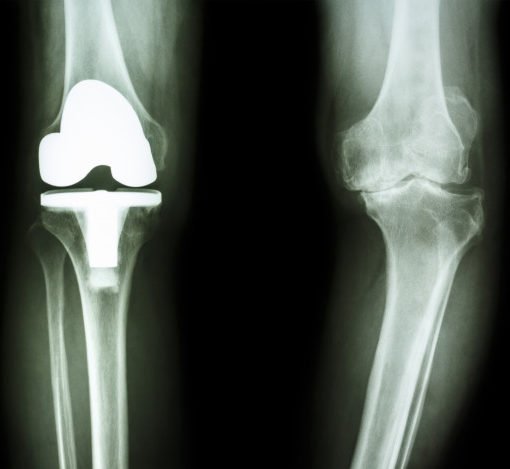 Dr. Francesco Melaragni