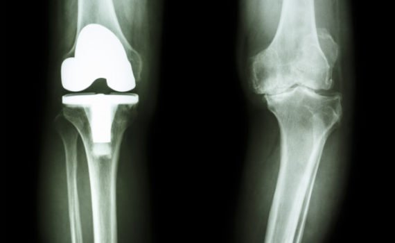 Dr. Francesco Melaragni